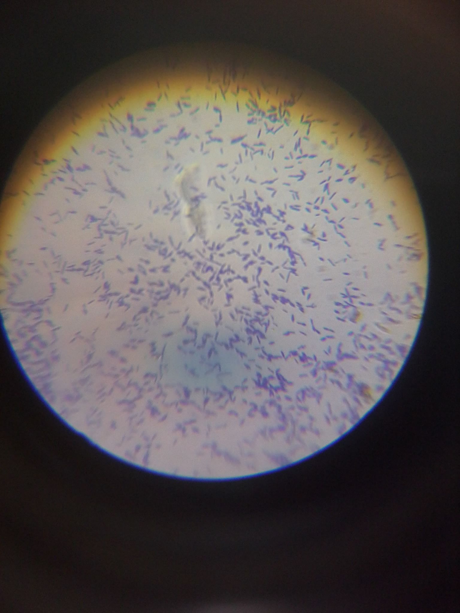 WHAT DO BACTERIA LOOK LIKE UNDER THE MICROSCOPE? — Steemit